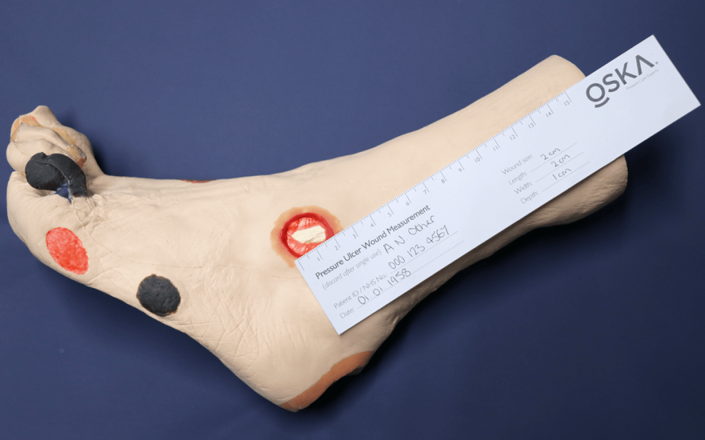 Capturing the best wound images